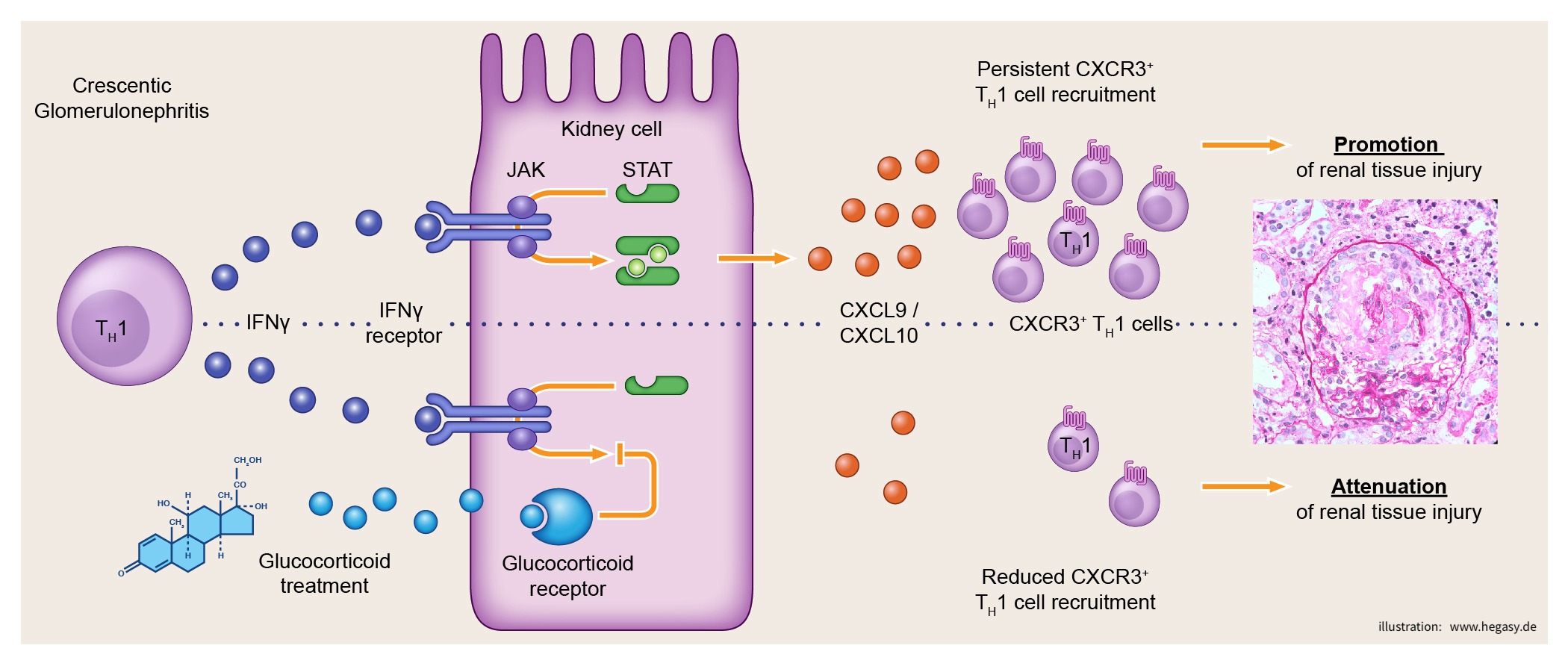 Graphical Abstract für JCI Insight mit T Zellen, Zytokinen und einem Glomerulum